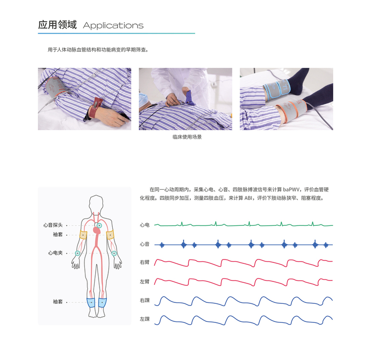 動脈硬化檢測儀應(yīng)用領(lǐng)域