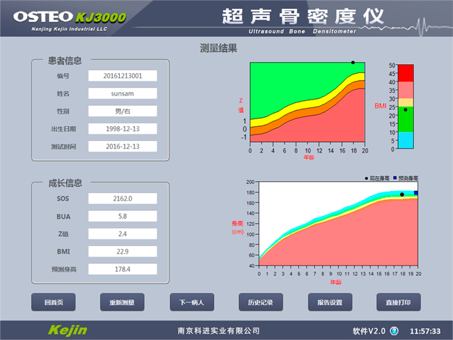 兒童骨密度檢測結(jié)果.jpg